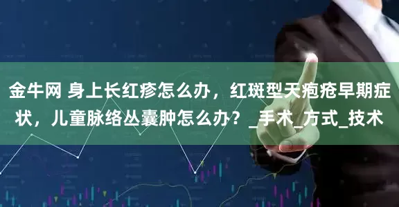 金牛网 身上长红疹怎么办，红斑型天疱疮早期症状，儿童脉络丛囊肿怎么办？_手术_方式_技术